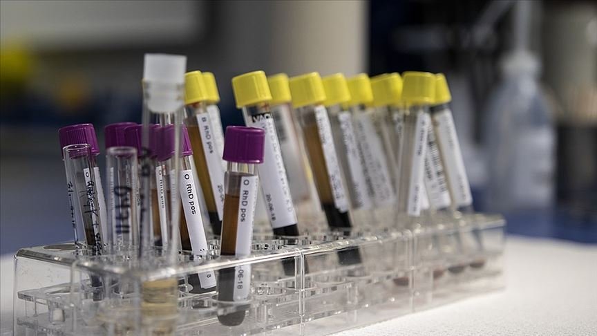 Hepatit: Küresel Bir Halk Sağlığı Krizi: Dünya Genelinde 304 Milyon Kişi HBV veya HCV ile Yaşıyor
